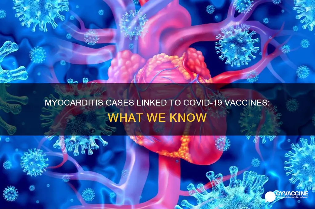 how many cases of myocarditis from the vaccine