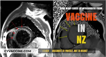 Myocarditis Cases Linked to Vaccines in New Zealand: What We Know