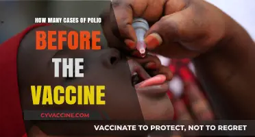 Polio's Pre-Vaccine Era: Understanding the Devastating Case Numbers