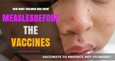 Measles Mortality: Pre-Vaccine Child Deaths and Historical Impact