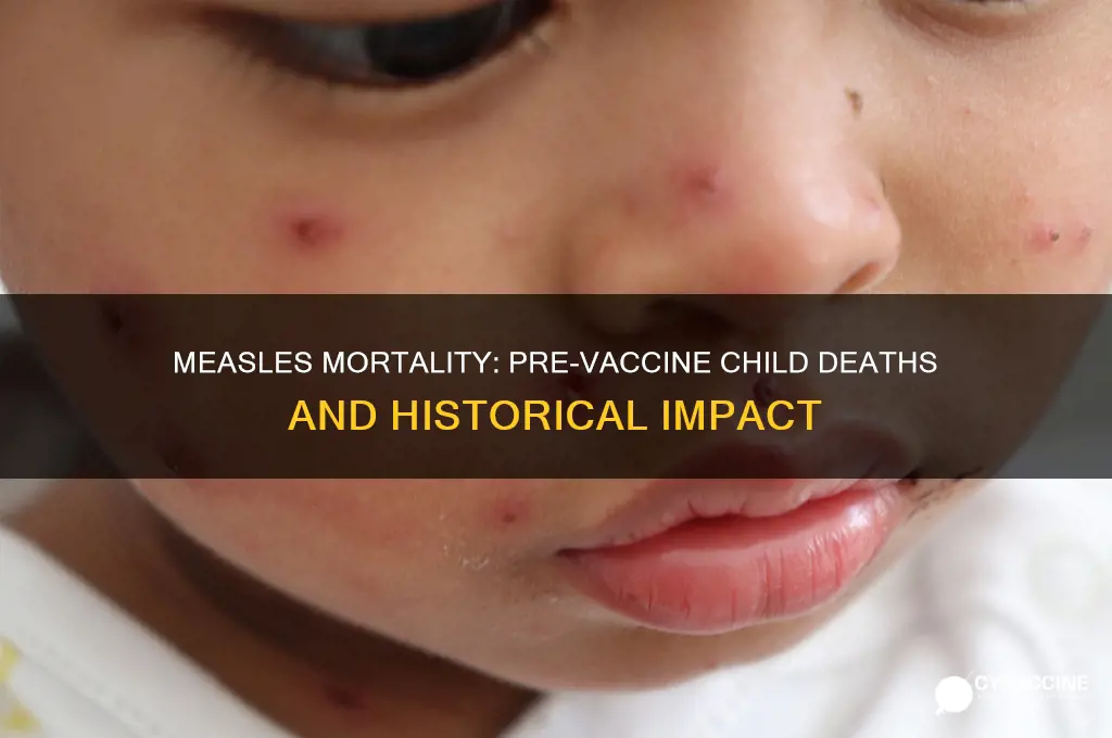how many children died from measlesbefore the vaccines