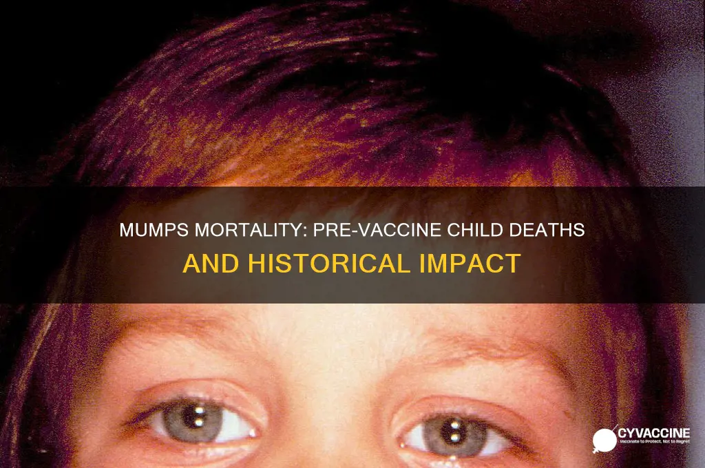 how many children died of mumps before vaccine