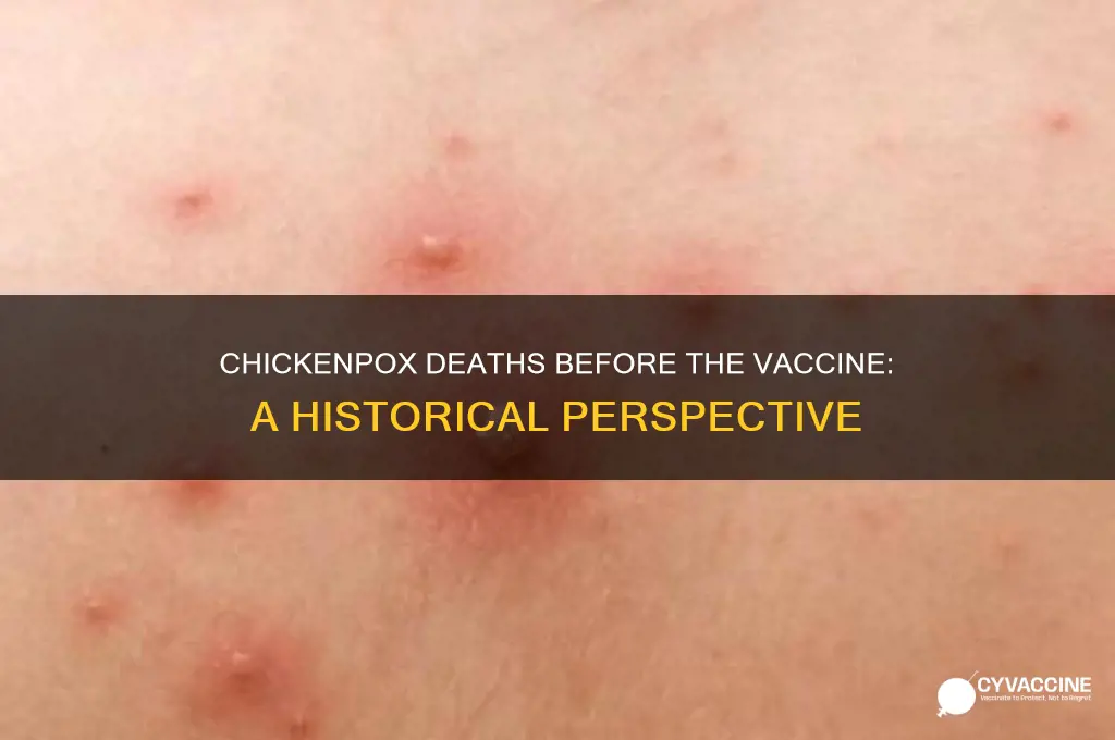 how many deaths before chickenpox vaccine