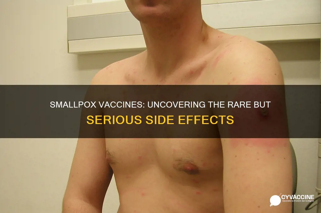 how many die due to small pox vaccines