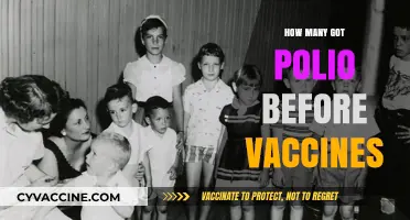 Polio's Pre-Vaccine Era: Understanding the Devastating Impact on Populations