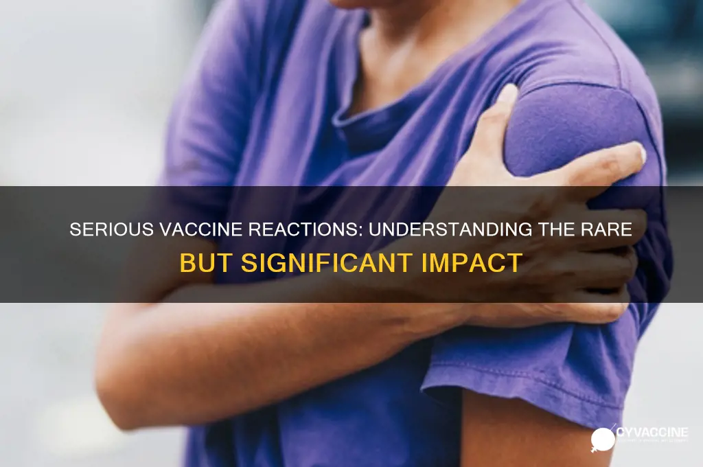 how many individuals have a serious reaction to vaccines