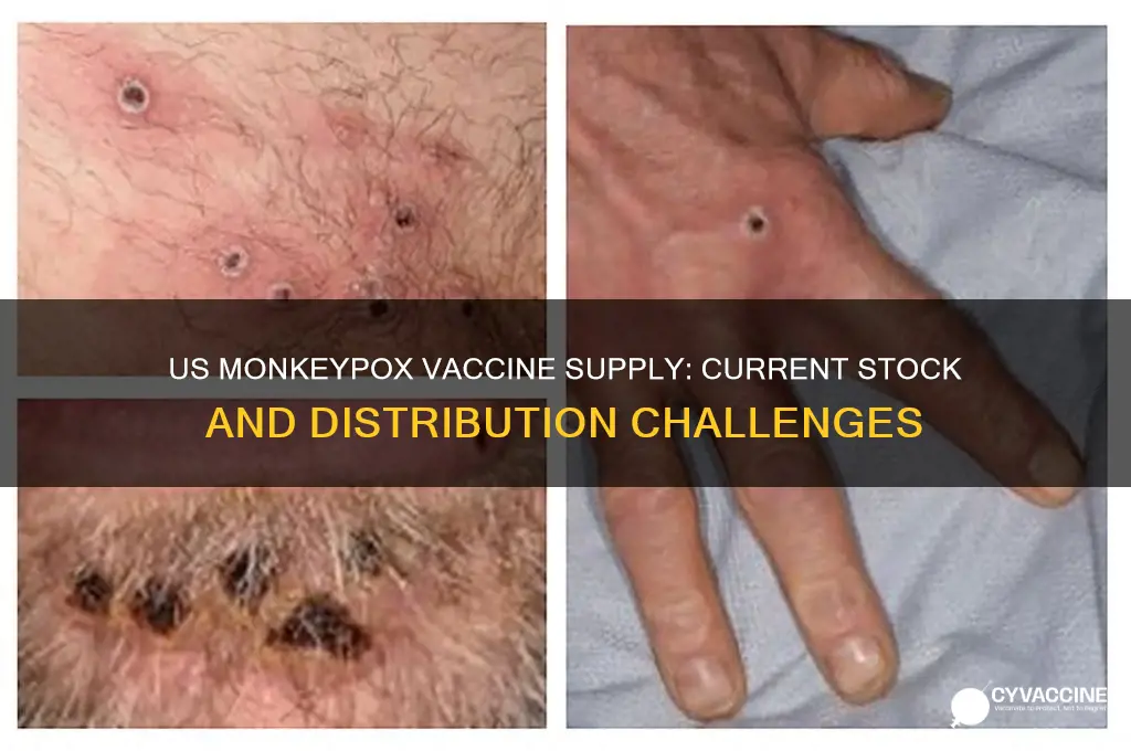 how many monkeypox vaccines does the us have