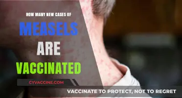 Vaccinated Measles Cases: Unraveling the Numbers and Trends
