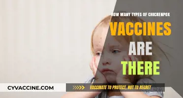 Exploring the Different Types of Chickenpox Vaccines Available Today