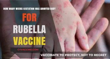 Rubella Vaccine Development: Uncovering the Gestation Truths Behind Aborted Fetus