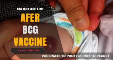 Post-BCG Vaccine Chest X-Ray Frequency: What You Need to Know