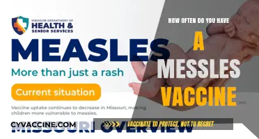 Understanding Measles Vaccine Frequency: How Often Should You Get It?