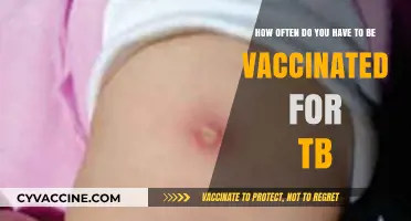 Understanding TB Vaccination Frequency: How Often Is It Necessary?