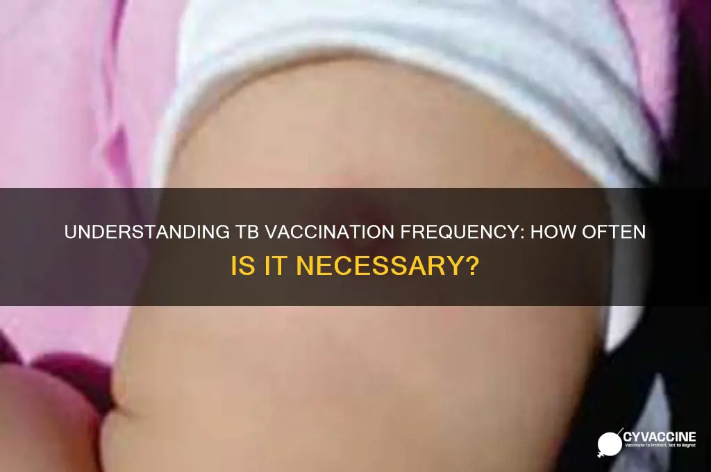 how often do you have to be vaccinated for tb