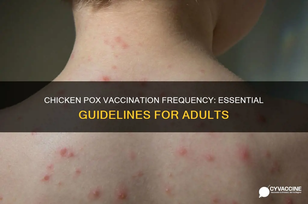 how often should an adult have the chicken pox vaccination