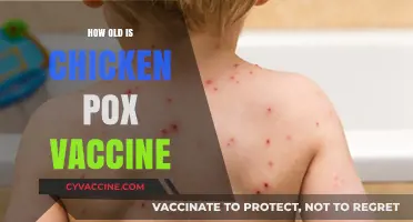 Understanding the Age of the Chickenpox Vaccine: A Comprehensive Guide