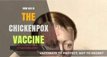 The Chickenpox Vaccine: A Historical Overview of Its Development
