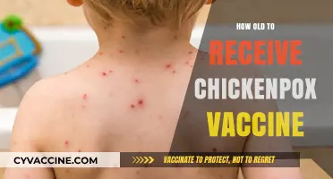 Chickenpox Vaccine Age: When Should Your Child Get Vaccinated?