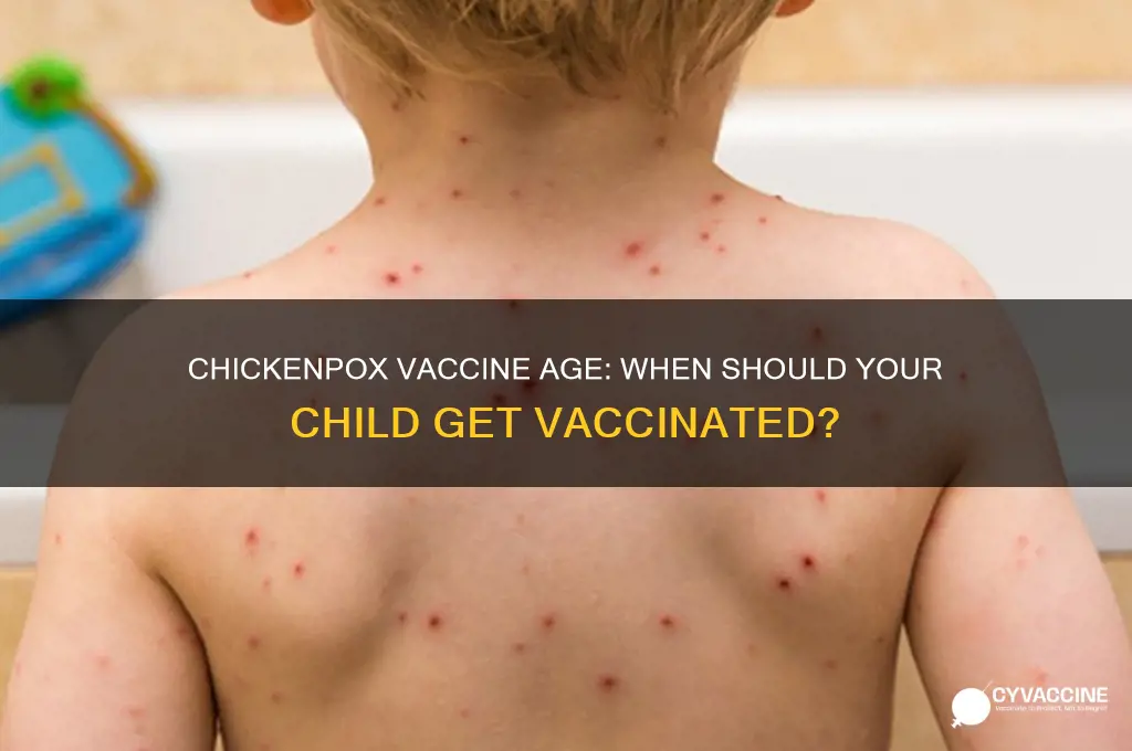 how old to receive chickenpox vaccine