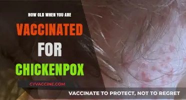 Understanding the Ideal Age for Chickenpox Vaccination: A Parent's Guide