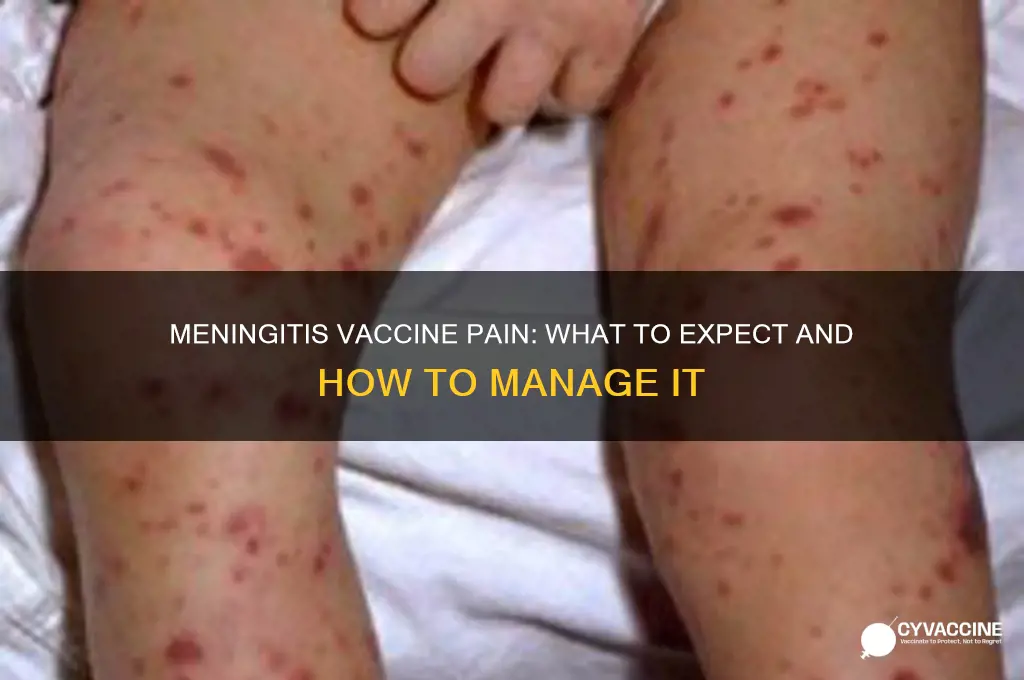 how painful is the meningitis vaccine