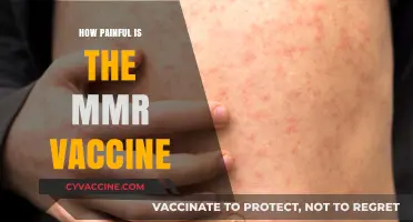 MMR Vaccine Pain: What to Expect and How to Manage It