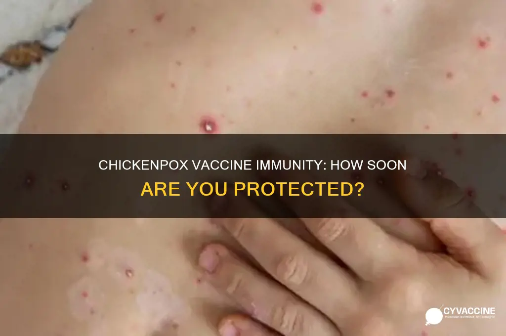 how soon after chickenpox vaccine are you immune