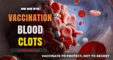 Blood Clots Post-Vaccination: Understanding Timing and Risks
