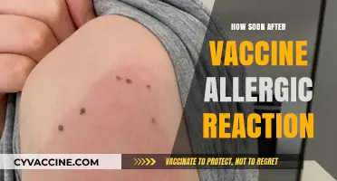 Vaccine Allergic Reaction Timeline: What to Expect and When to Act