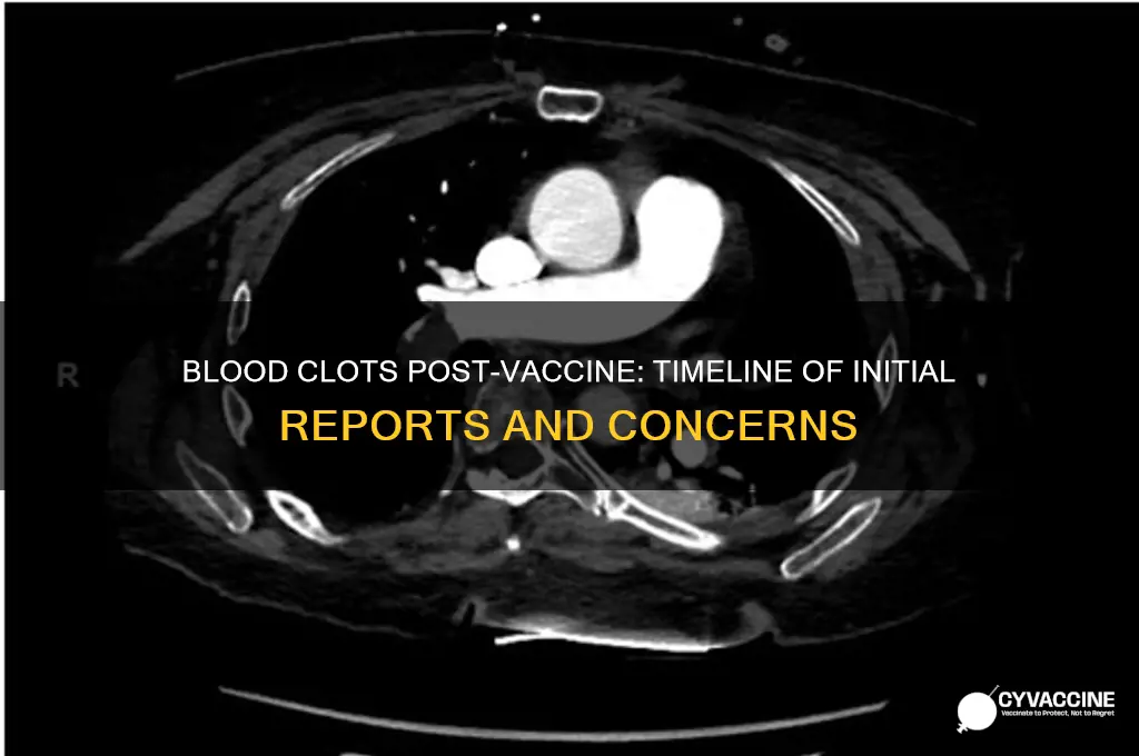 how soon after vaccine were blood clots reported