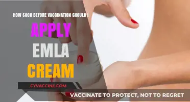 When to Apply EMLA Cream Before Vaccination: Timing Tips