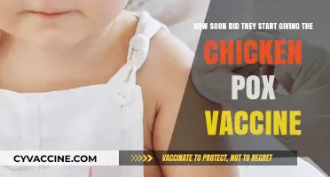 When Did Chickenpox Vaccination Begin? A Timeline of Its Introduction