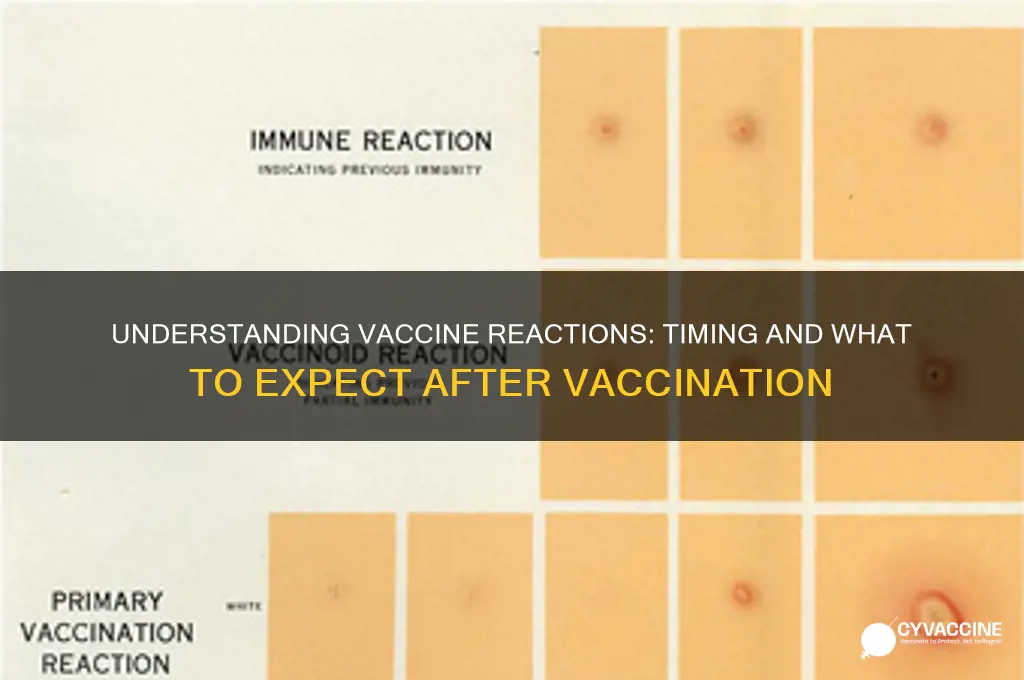 how soon do vaccine reactions happen