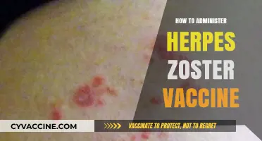 Effective Herpes Zoster Vaccine Administration: A Step-by-Step Guide