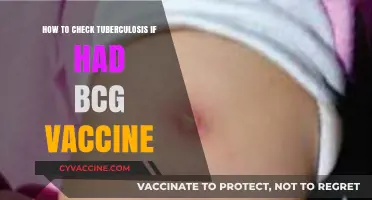 BCG Vaccine and TB Testing: What You Need to Know