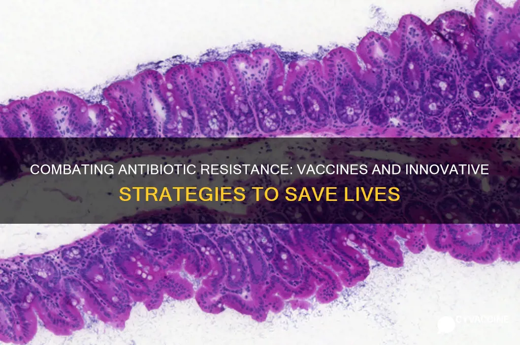 how to eliminate antibiotic resistance such as vaccines