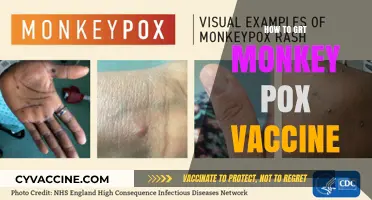 How to Get the Monkeypox Vaccine: A Step-by-Step Guide