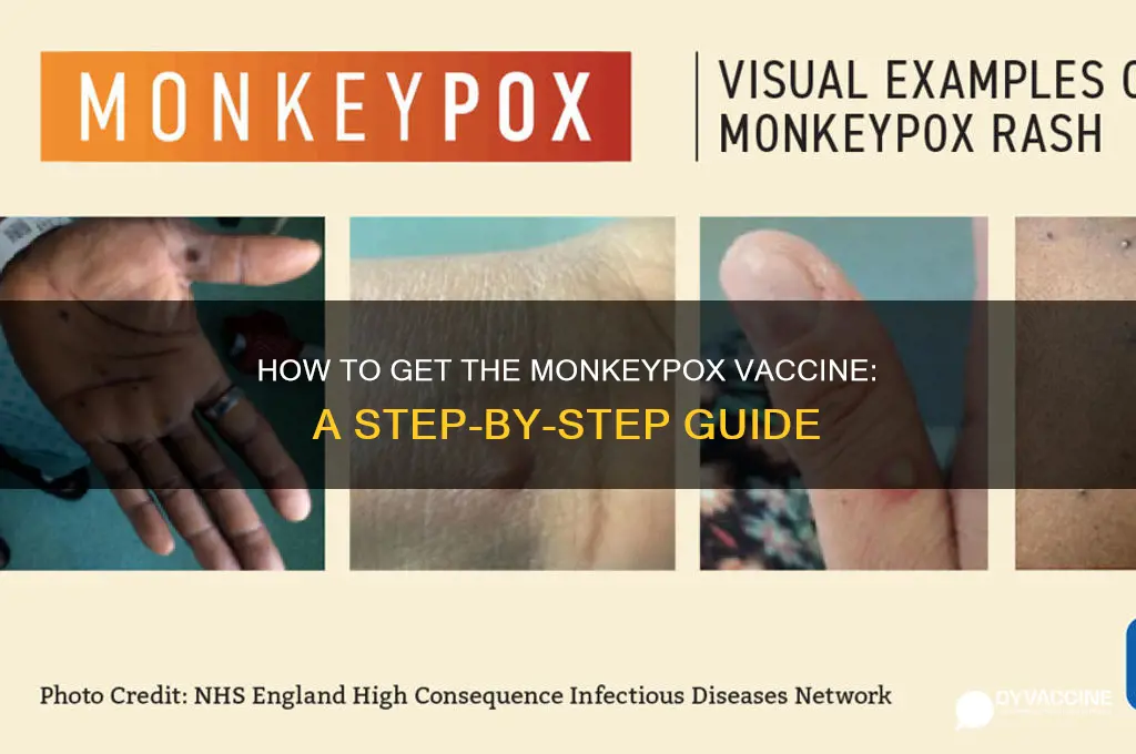 how to grt monkey pox vaccine
