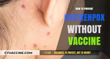 Preventing Chickenpox Naturally: Effective Strategies Without Vaccination