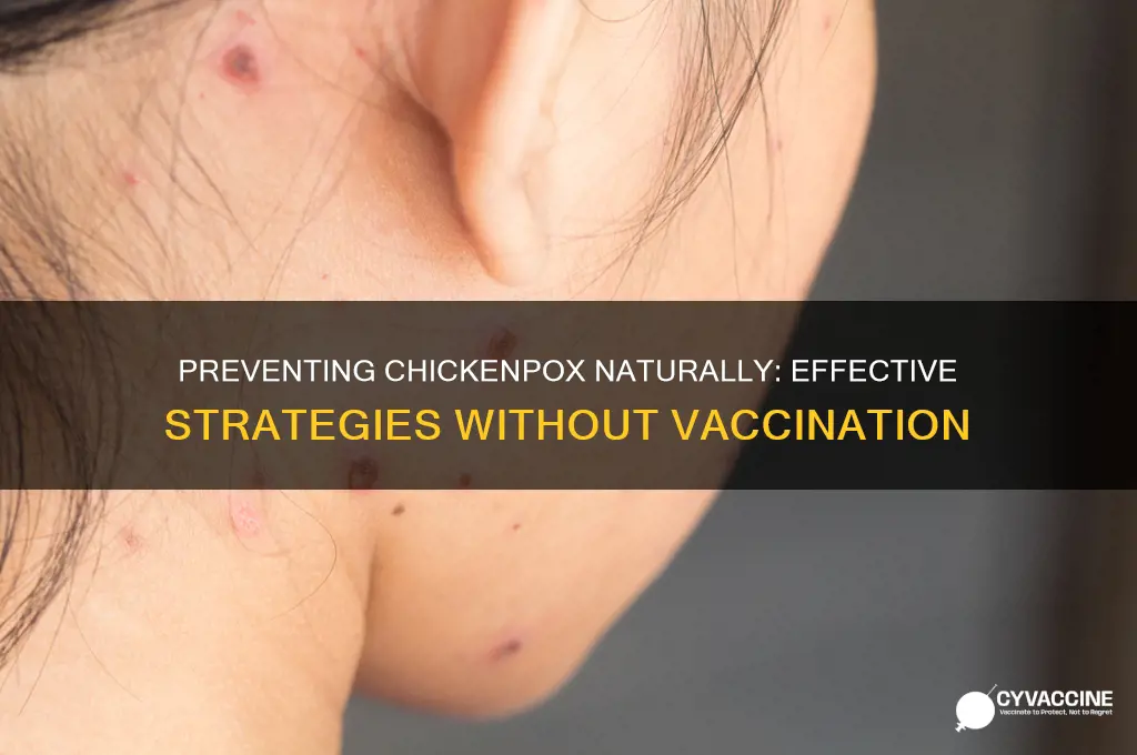 how to prevent chickenpox without vaccine
