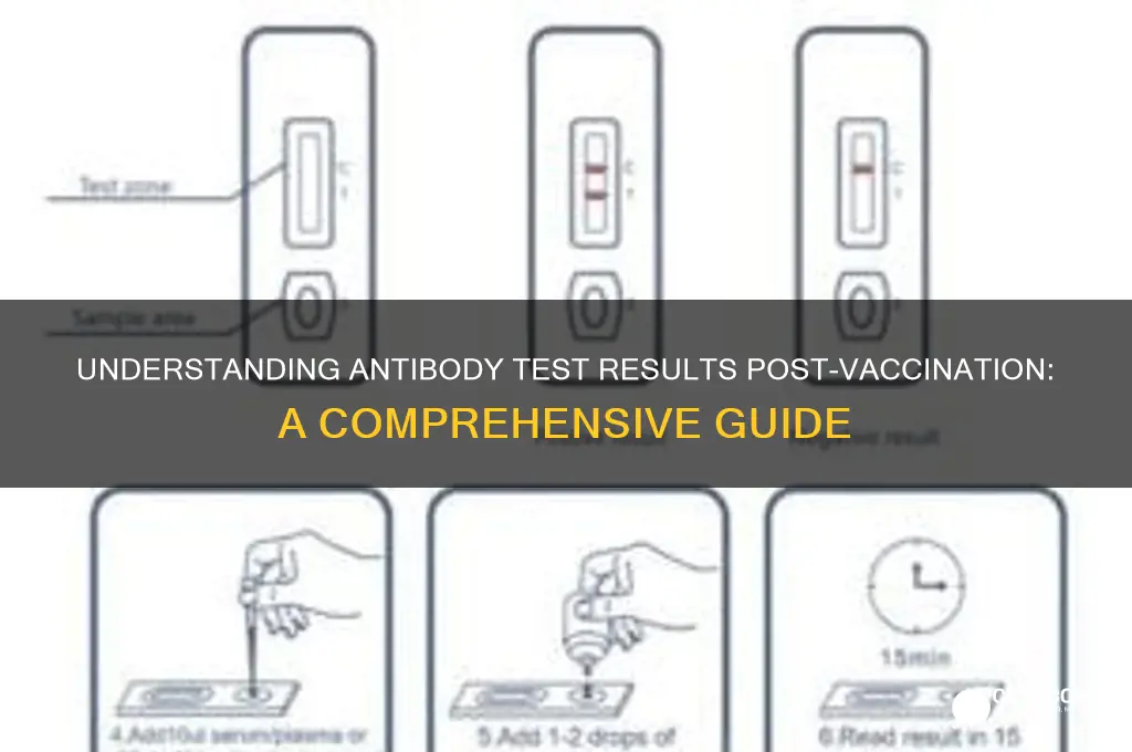 how to read antibody test results after vaccine