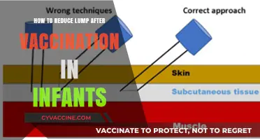 Effective Tips to Reduce Lumps After Infant Vaccinations Safely