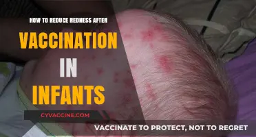 Soothing Infant Skin: Tips to Reduce Redness After Vaccination