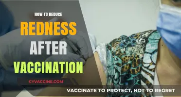 Soothing Redness: Post-Vaccination Care Tips for Healthy Skin