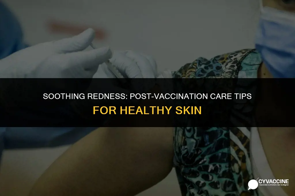 how to reduce redness after vaccination