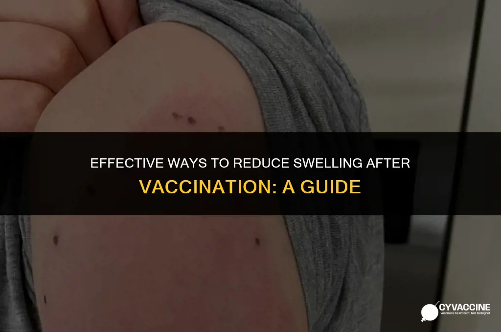 how to reduce swelling after vaccination