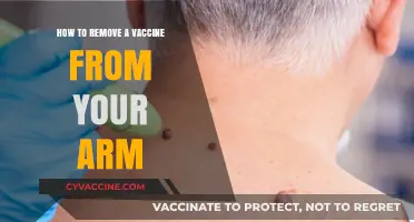 Effective Steps to Safely Remove a Vaccine Lump from Your Arm