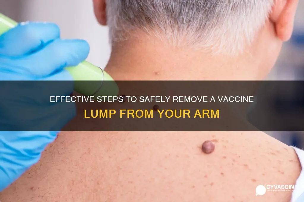 how to remove a vaccine from your arm