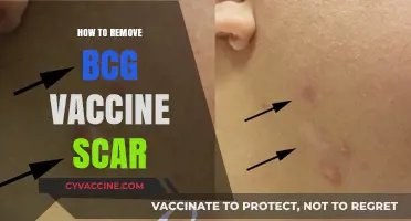 Effective Ways to Remove BCG Vaccine Scars: A Comprehensive Guide