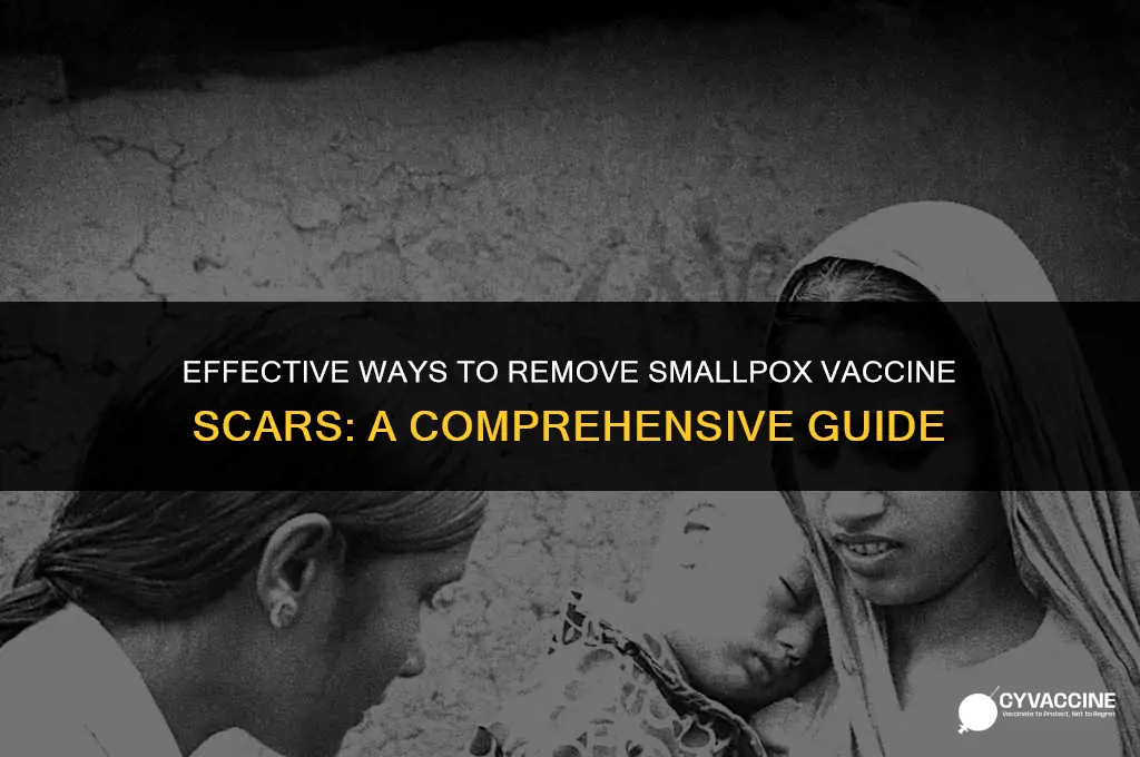 how to remove smallpox vaccine scar